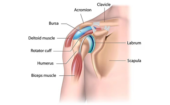 Rotator Cuff Tear